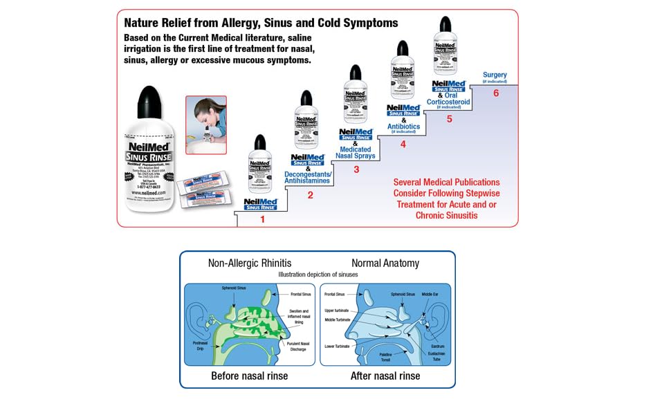 NeilMed Sinus Rinse - Complete Nasal Irrigation Kit (50 Count)