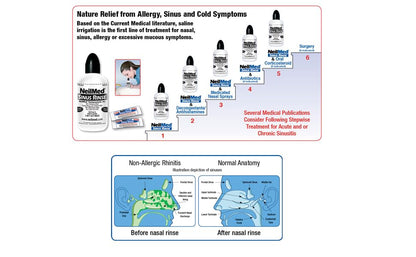 NeilMed Sinus Rinse - Complete Nasal Irrigation Kit (50 Count)