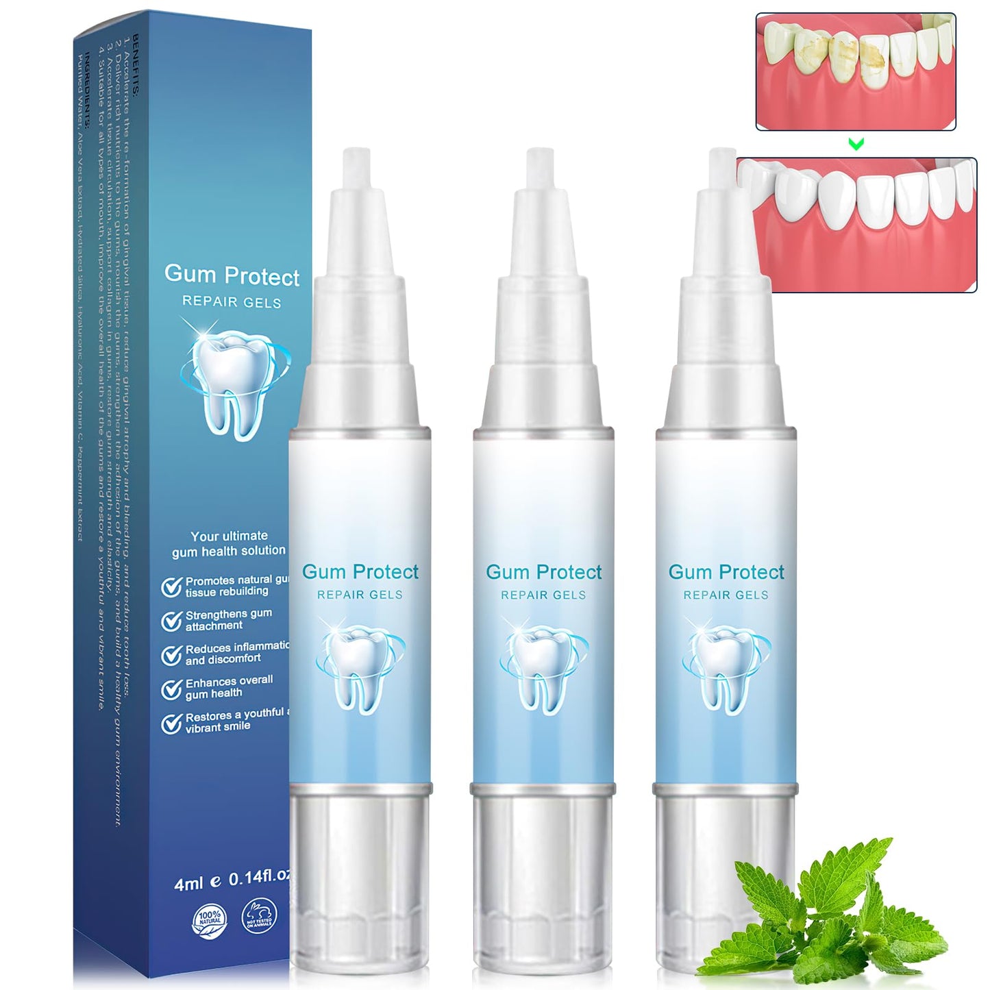 Neslemy Gum Shield Therapy Gel – Teeth Whitening Pen & Gum Treatment Kit (3PCS)