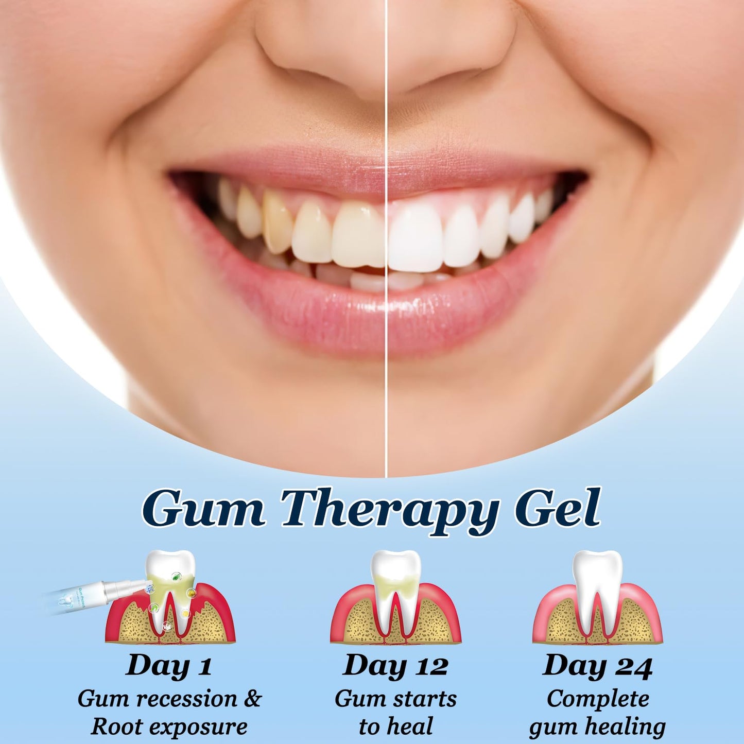 Neslemy Gum Shield Therapy Gel – Teeth Whitening Pen & Gum Treatment Kit (3PCS)