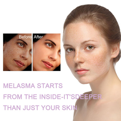 NEWUREHO Melanina Anti-Melasma Capsules – DIM, KSM-66 & Turmeric (60 Caps)