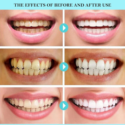 Niacinamide Whitening Toothpaste – Enamel Safe, Fluoride-Free, Vegan | Fresh Mint