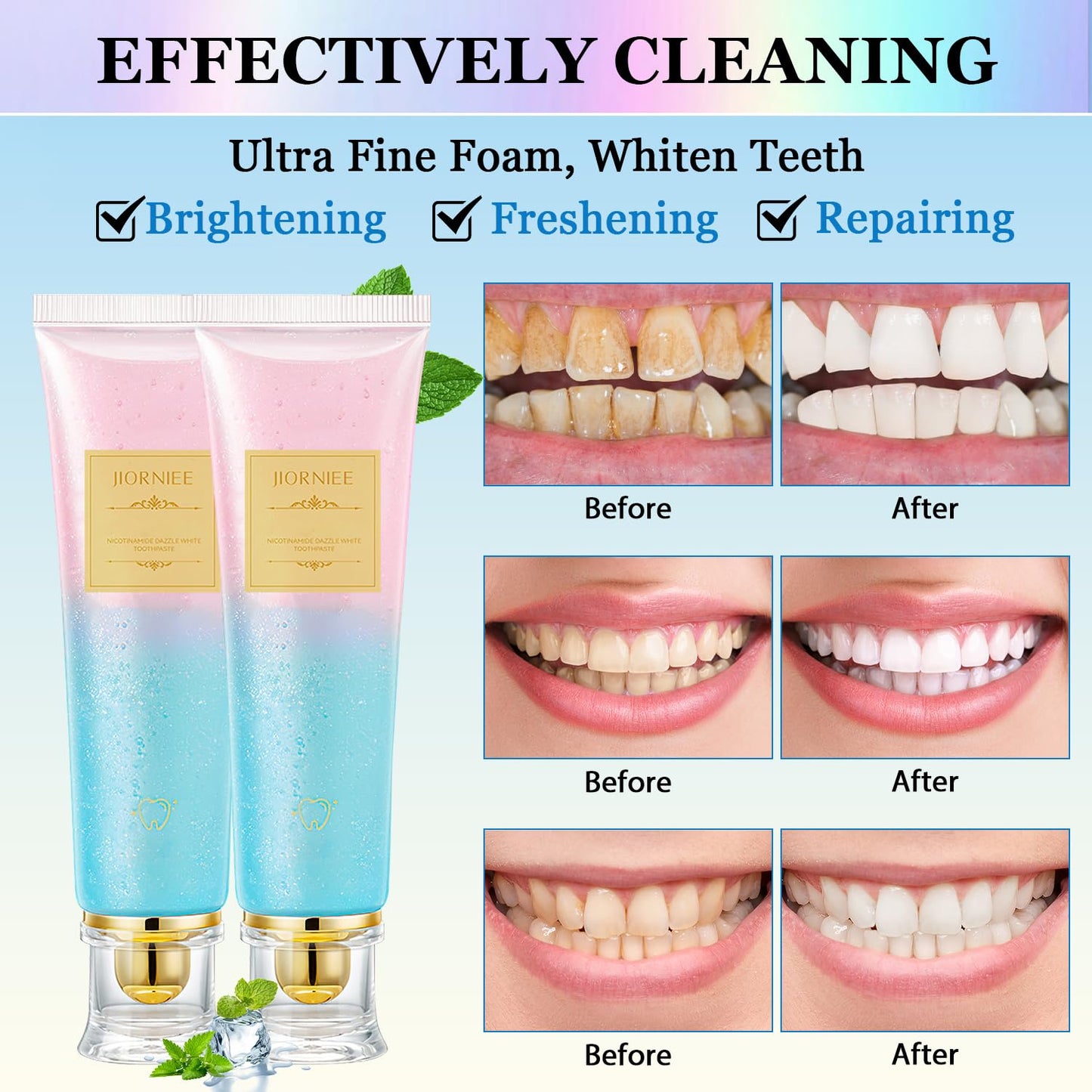 2PCS Niacinamide Toothpaste – Whitening, Enamel Repair & Fresh Breath