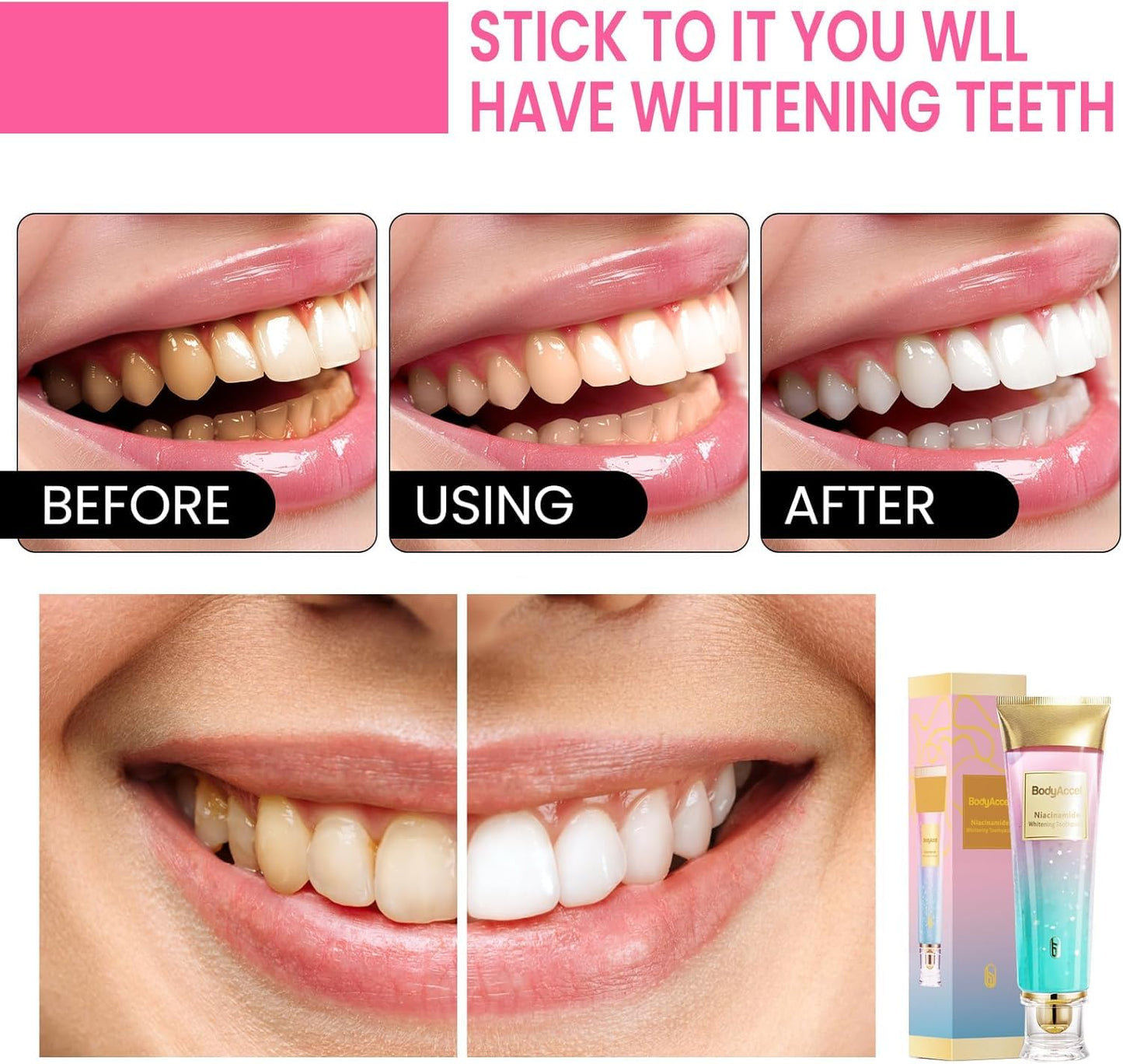 3 Pack Niacinamide Whitening Toothpaste | BodyAccel Triple Whitening, Stain Removal & Fresh Breath