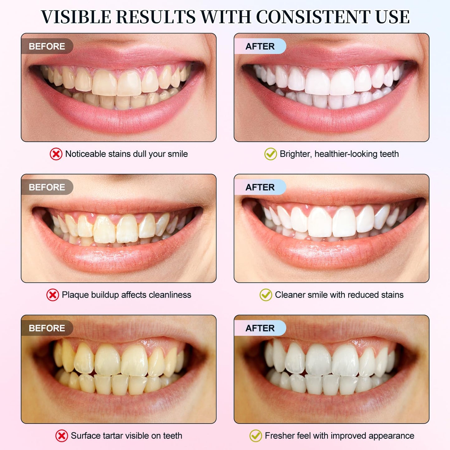 Niacinamide Whitening Toothpaste | Intensive Whitening, Stain Removal, Enamel Protection (1PC)