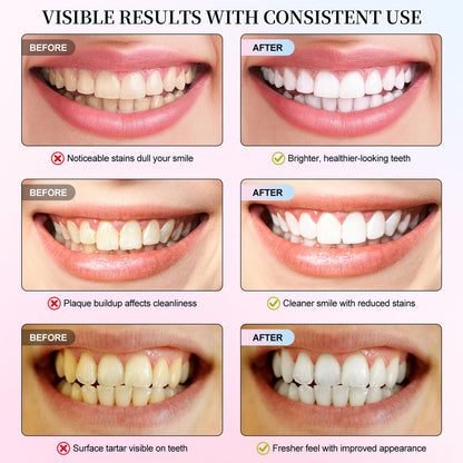 Niacinamide Whitening Toothpaste | Intensive Whitening, Stain Removal, Enamel Protection (1PC)