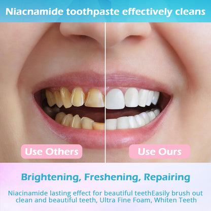 Niacinamide Whitening Toothpaste – 3 Pack Mint | YanxiananYagao