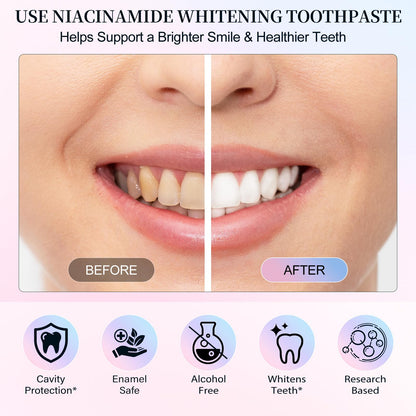 Niacinamide Whitening Toothpaste 3.5oz – Stain Removal & Enamel Protection