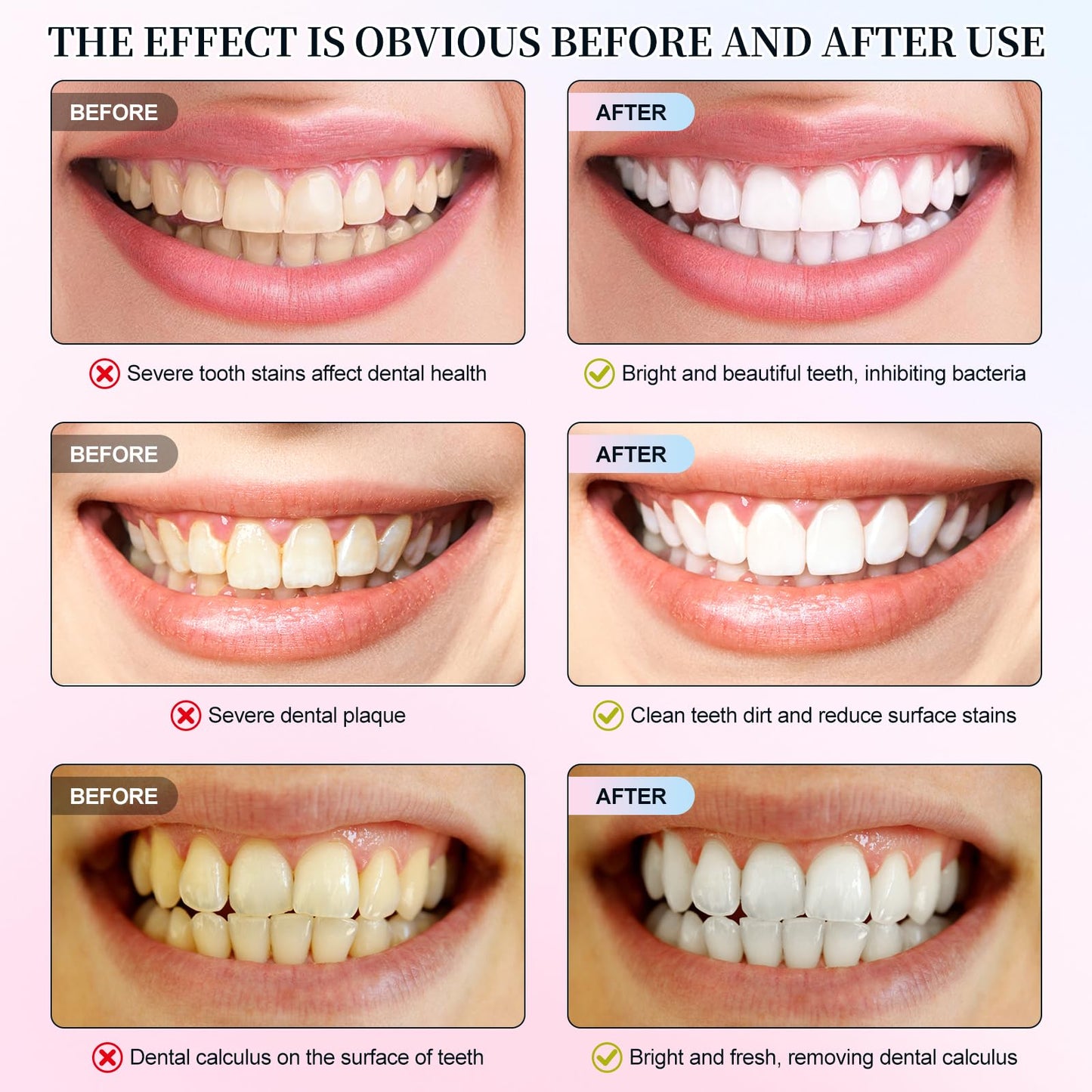 Niacinamide Whitening Toothpaste – Whitens Teeth, Protects Enamel, Freshens Breath for Sensitive Teeth