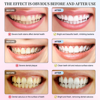 Niacinamide Whitening Toothpaste – Whitens Teeth, Protects Enamel, Freshens Breath for Sensitive Teeth