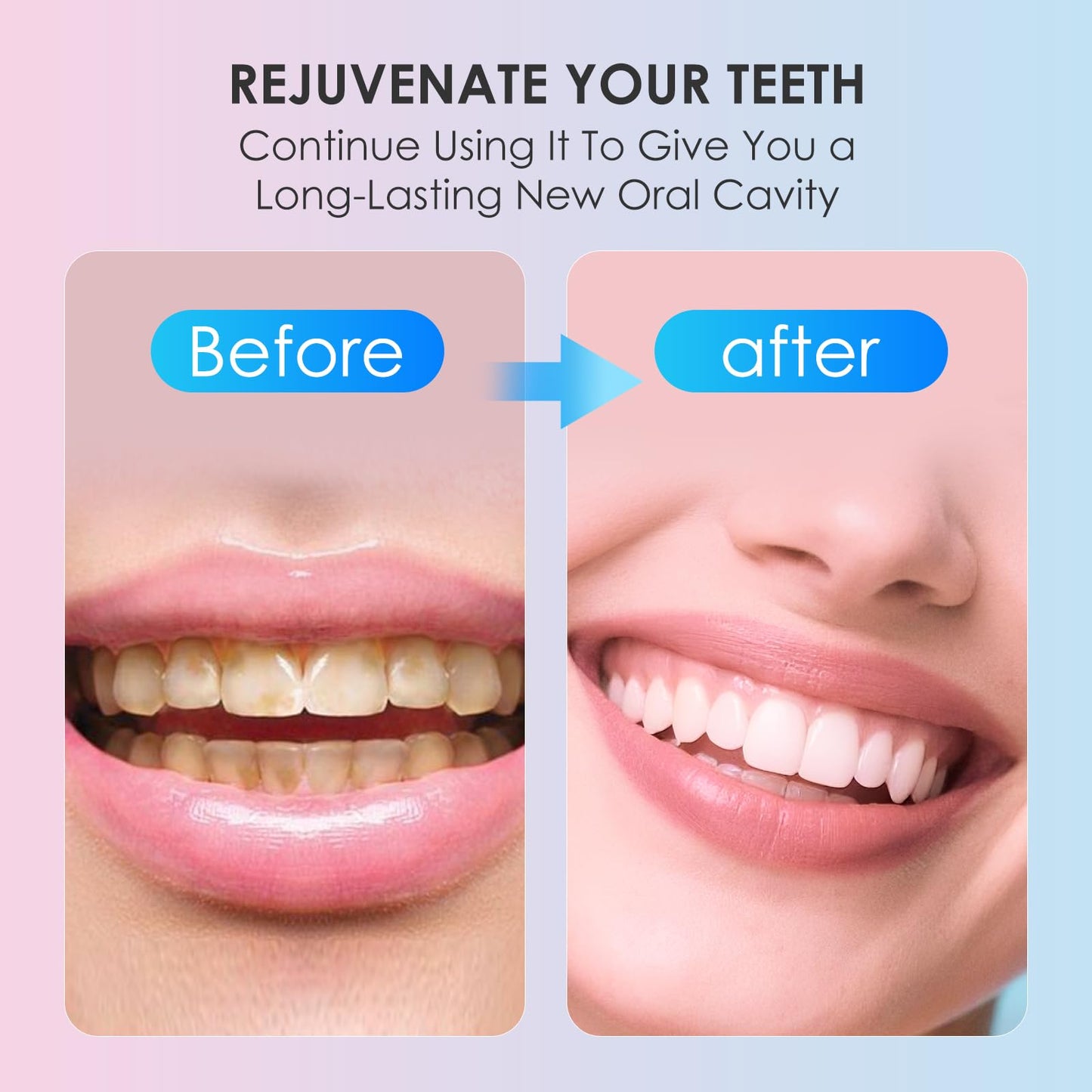 Niacinamide Whitening Toothpaste – Stain Removal, Fresh Breath, Gum Support – Bright White Formula with Nicotinamide – 2025 Upgrade 2pcs