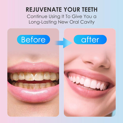 Niacinamide Whitening Toothpaste – Stain Removal, Fresh Breath, Gum Support – Bright White Formula with Nicotinamide – 2025 Upgrade 2pcs