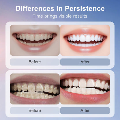 Niacinamide Whitening Toothpaste – Gentle Stain Removal & Fresh Breath (Mint)