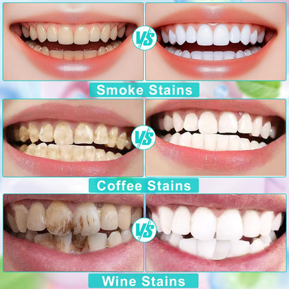 Niacinamide Whitening Toothpaste – Natural, Mild & Non-Irritating for Fresh Breath and Oral Health