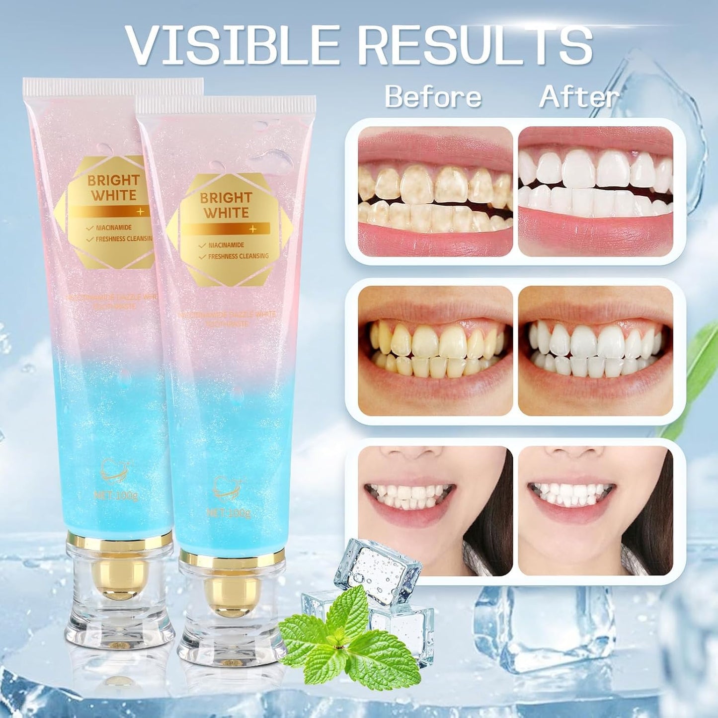 2PC Niacinamide Whitening Toothpaste – Gentle Mint, Fresh Breath & Stain Removal