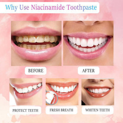 Niacinamide Whitening Toothpaste | Probiotic, Fluoride-Free, Sensitivity Relief