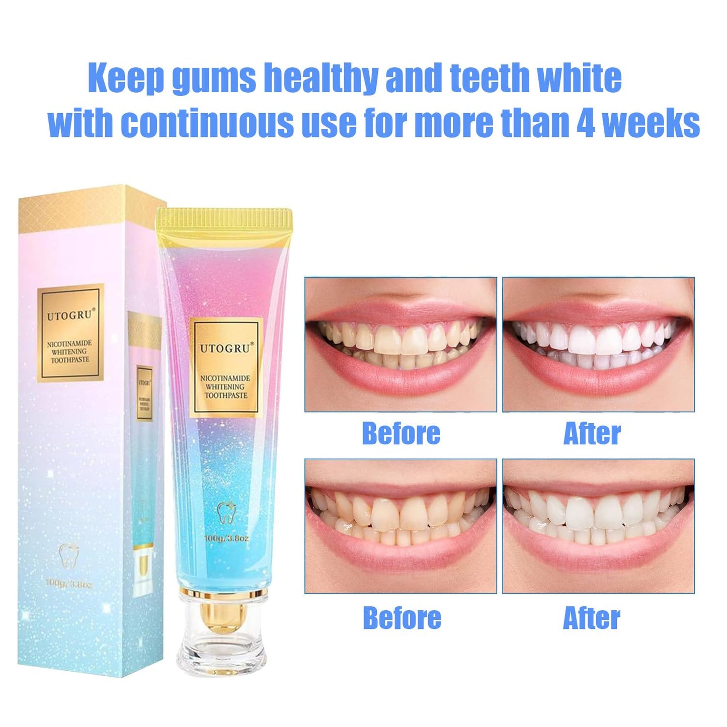Niacinamide Whitening Toothpaste by Utogru – Enamel Care & Fresh Breath