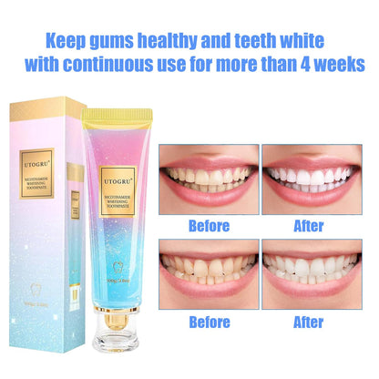Niacinamide Whitening Toothpaste by Utogru – Enamel Care & Fresh Breath