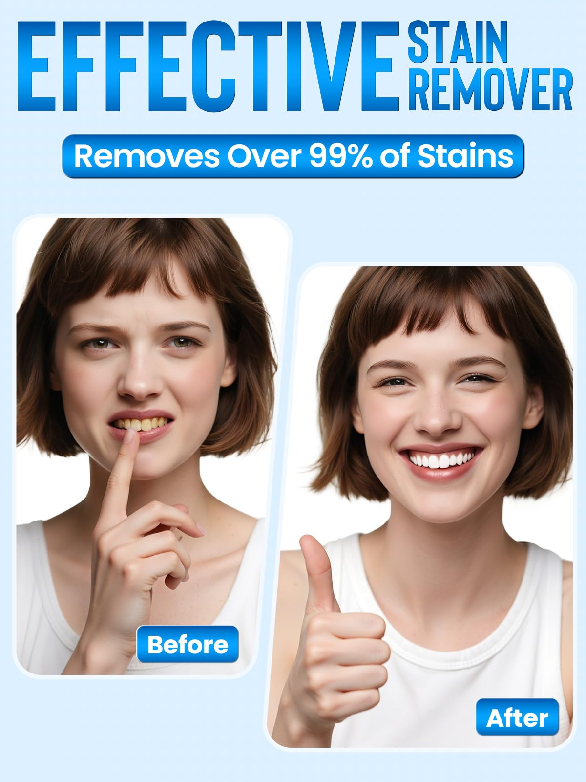 Nicwell Teeth Whitening Kit for Sensitive Teeth – 3x 35% Carbamide Peroxide + LED Light