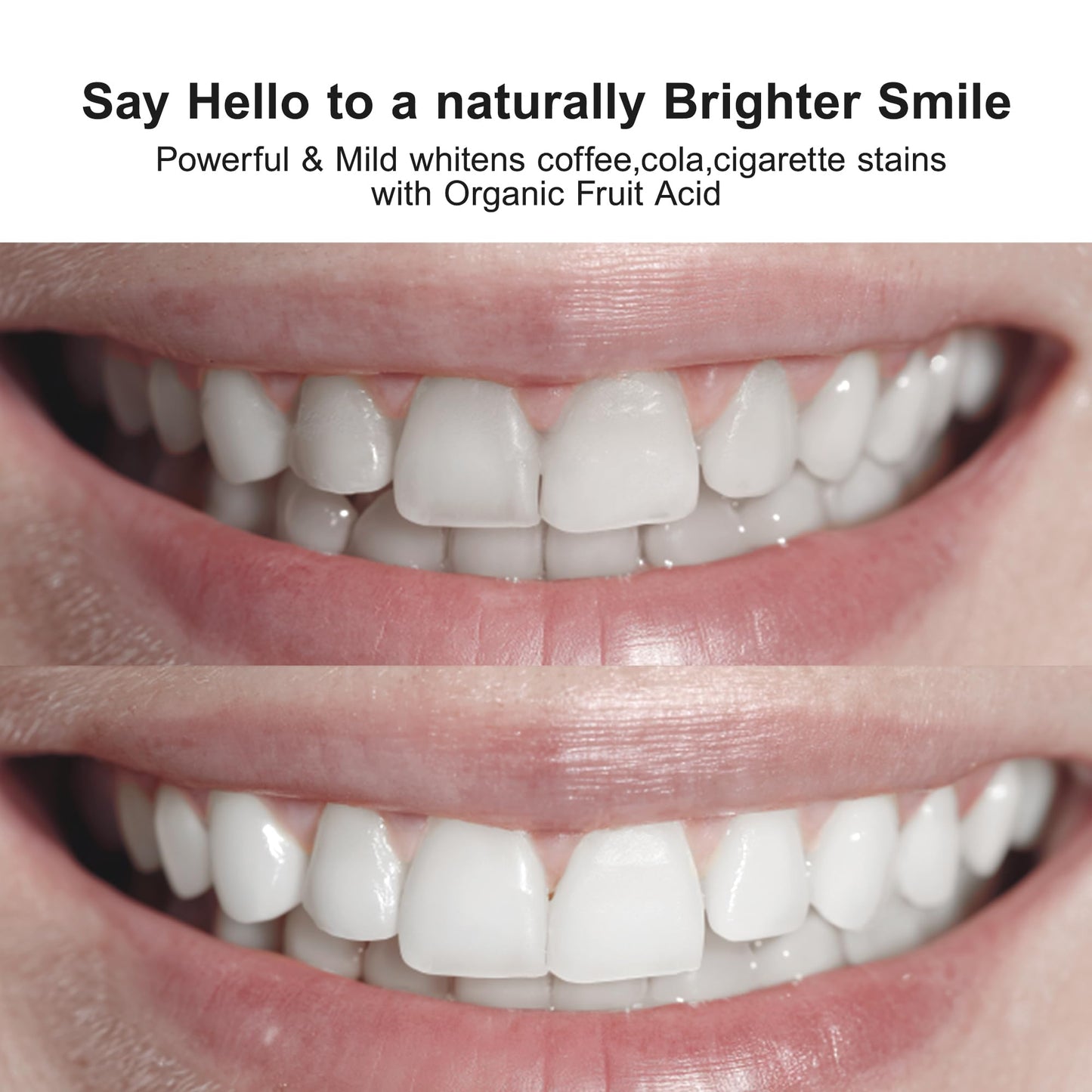 Nobaton 1% Fruit Acid Whitening Ampoule Toothpaste with Nano HAP – Enamel-Safe Brightening (3 Bottles, 1.23 oz Each)