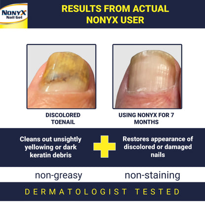 NONYX Fungal Nail Clarifying Gel | Clinically Proven for Discolored, Thick Nails (90% Improvement) | Made in USA