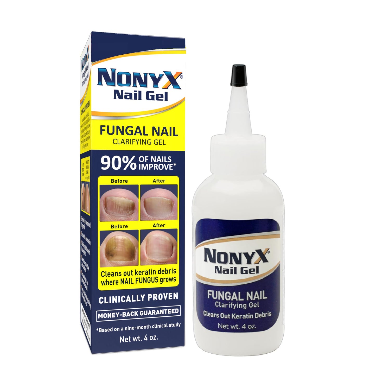 NONYX Fungal Nail Clarifying Gel | Clinically Proven for Discolored, Thick Nails (90% Improvement) | Made in USA