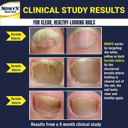 NONYX Fungal Nail Clarifying Gel | Clinically Proven for Discolored, Thick Nails (90% Improvement) | Made in USA