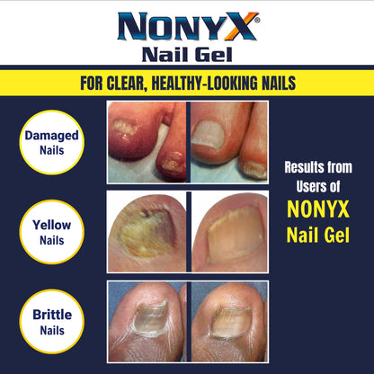 NONYX Fungal Nail Clarifying Gel | Clinically Proven for Discolored, Thick Nails (90% Improvement) | Made in USA