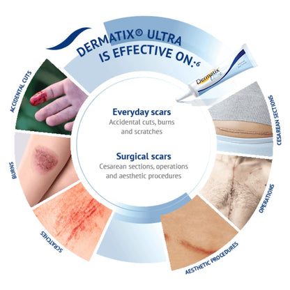 NOUVOS Dermatix Ultra Advanced Scar Gel - 15g | Softens, Flattens, Quick-Drying & Odorless