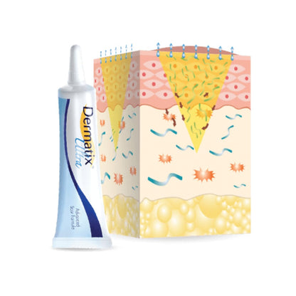 NOUVOS Dermatix Ultra Advanced Scar Gel - 15g | Softens, Flattens, Quick-Drying & Odorless