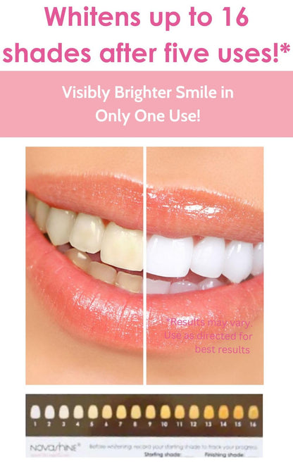 Novashine Professional Teeth Whitening Kit | Advanced Blue LED Light, Concentrated Peroxide Gel