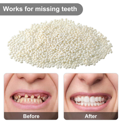 Nuanchu 100g Bead Teeth Moldable Gel Filler for Missing Teeth | Halloween Makeup