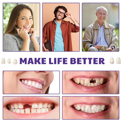 Nuanchu DIY Dentures Kit - 56 Synthetic Resin Teeth, Tweezers & Storage Boxes