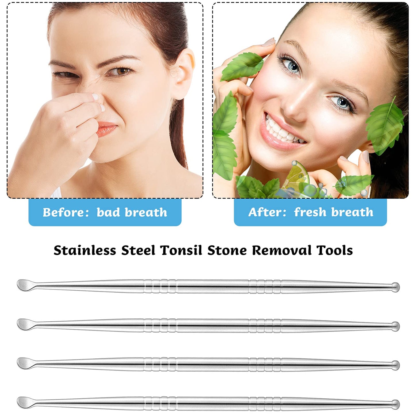 Nuanchu 4-Piece Stainless Steel Tonsil Stone Removal Tools - Bad Breath Solution
