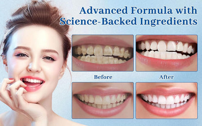 Nudenta Odontic Repair Tooth Armor Liquid – Nano Hydroxyapatite Remineralization Drops (2x60ml)