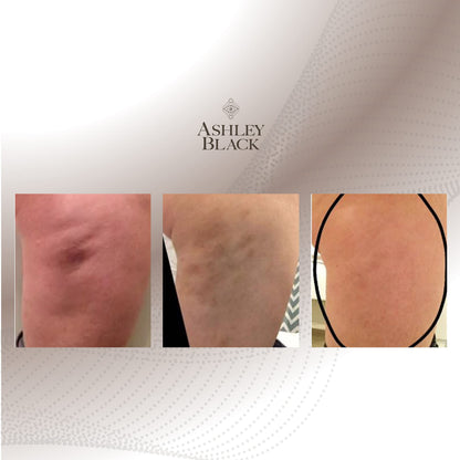 Nugget by Ashley Black - Deep Tissue Muscle Therapy for Athletes - Full Body Massage and Recovery Tool