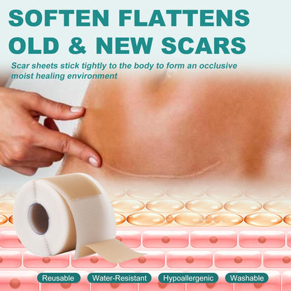 Nullam Silicone Scar Sheets & Tape Roll (1.6 x 59 in) for Surgical, C-Section & Keloid Scars