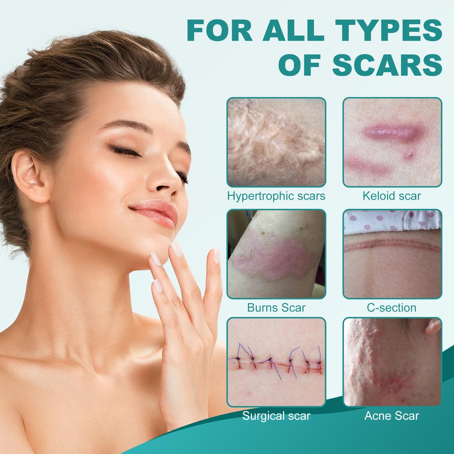 Nullam Silicone Scar Sheets & Tape – Reusable, Breathable Scar Care (1.6 x 158 in)
