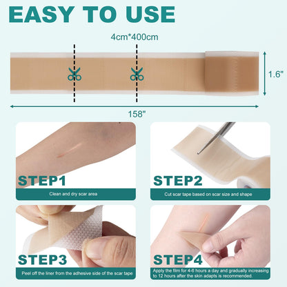 Nullam Silicone Scar Sheets & Tape – Reusable, Breathable Scar Care (1.6 x 158 in)