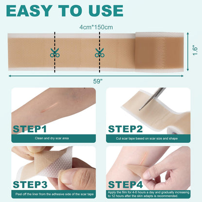 Nullam Silicone Scar Sheets & Tape Roll (1.6 x 59 in) for Surgical, C-Section & Keloid Scars
