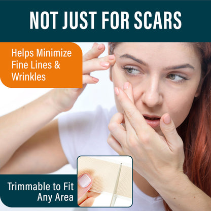 NUVADERMIS Silicone Scar Tape Roll 120in x 1.5in – Medical-Grade, Reusable Scar Sheets (2 Pack)