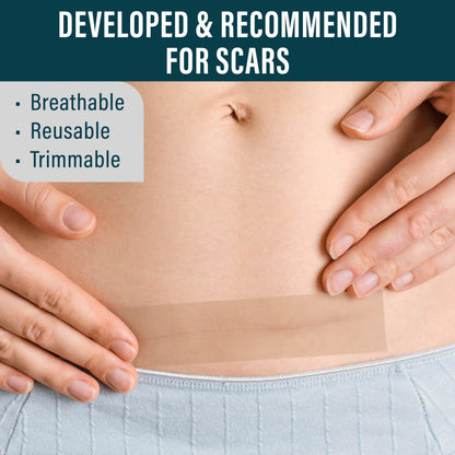 NUVADERMIS Silicone Scar Sheets - 120x1-5 Roll - Medical-Grade Scar Tape for Surgical Scars Wrinkles and Keloids