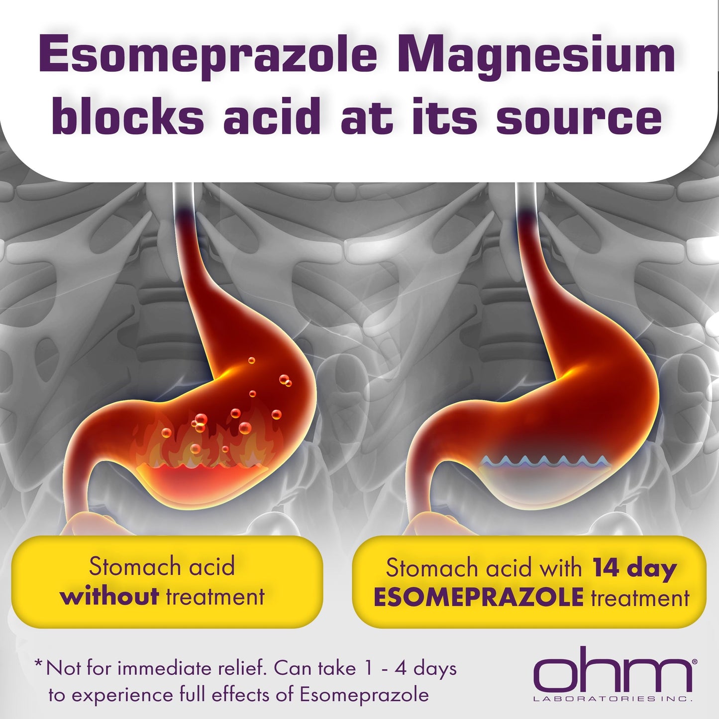 Ohm Esomeprazole Magnesium 20 mg Delayed-Release Capsules – 24-Hour Heartburn & Acid Reflux Relief (84-count)