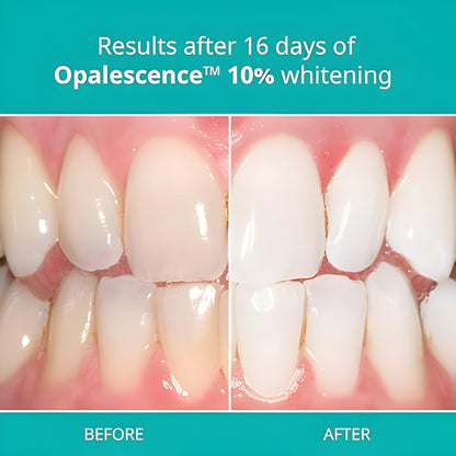 Opalescence 10% Gel Teeth Whitening Refills (4 Syringes) Melon - Ultradent
