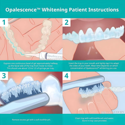 Opalescence 10% Teeth Whitening Kit - 12 Syringes, Low Sensitivity - Made in USA by Ultradent (5211-6)