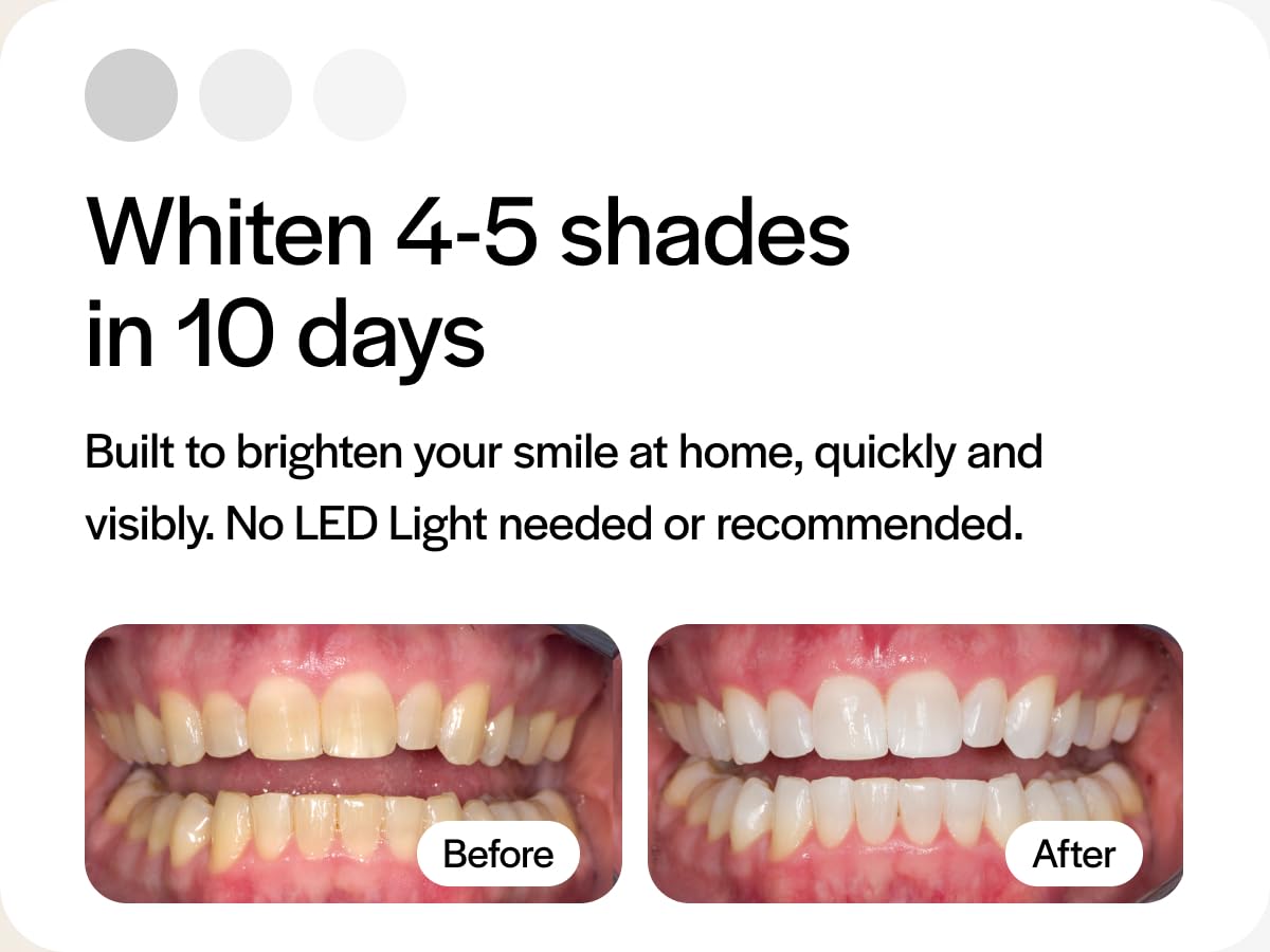 Opalescence 10% Teeth Whitening Kit - 12 Syringes, Low Sensitivity - Made in USA by Ultradent (5211-6)