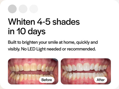 Opalescence 10% Teeth Whitening Kit - 12 Syringes, Low Sensitivity - Made in USA by Ultradent (5211-6)