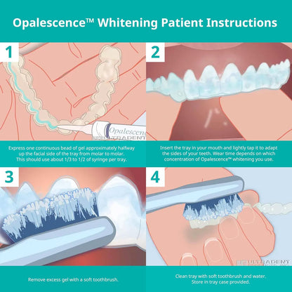 Opalescence 35% Mint Gel Syringes Refill Kit (4 Count) – Ultradent