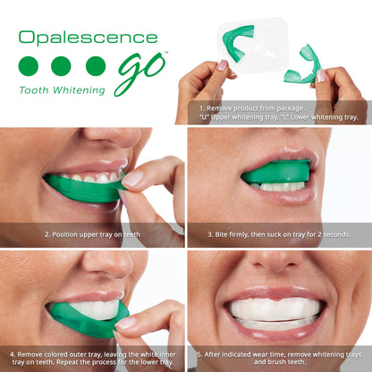 Opalescence Go 10% Mint Teeth Whitening Kit – 10 Treatments GO10-5193-1