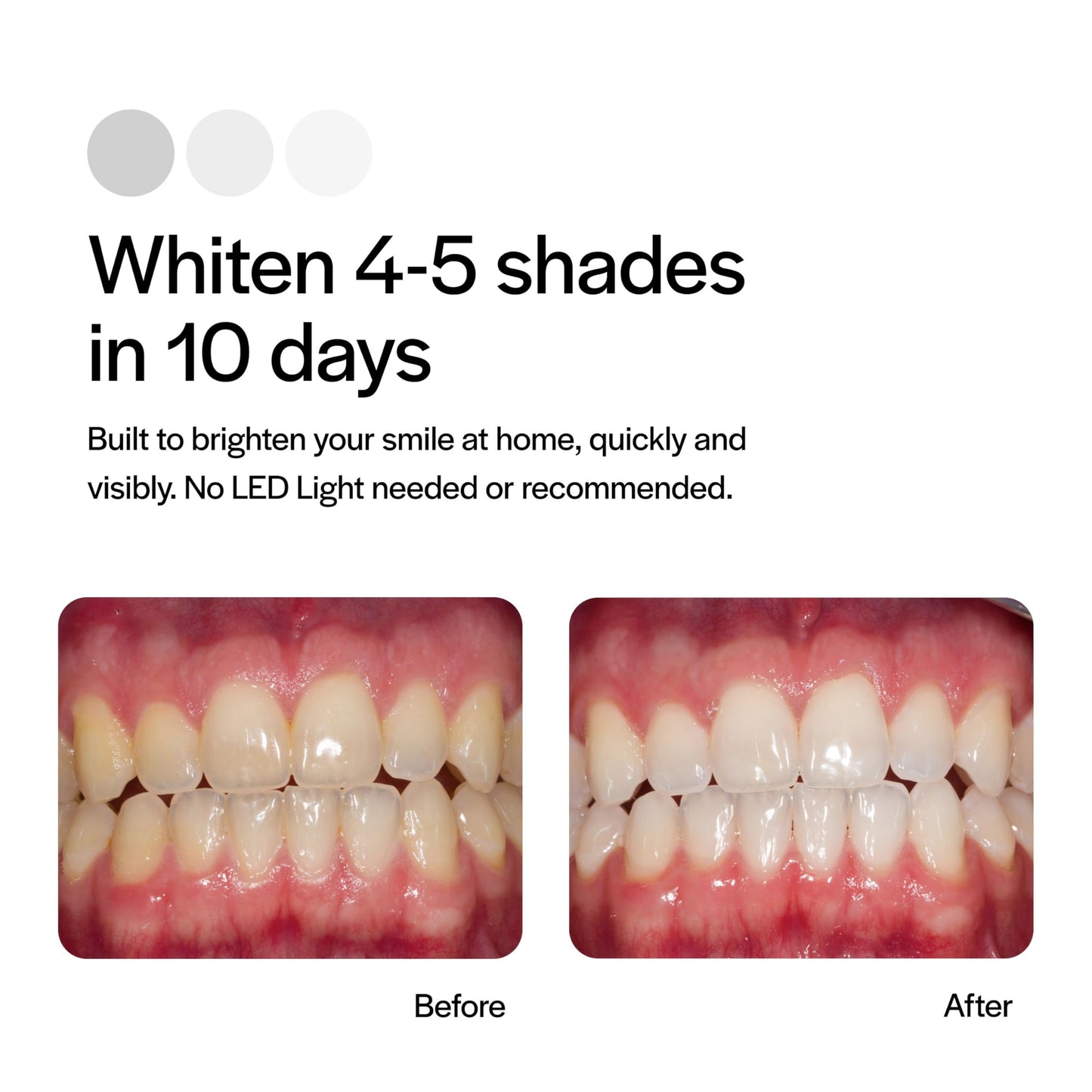 Opalescence GO 15 Whitening Bundle | 7 Treatments | Prefilled Trays + Travel Sensitive Toothpaste Mint
